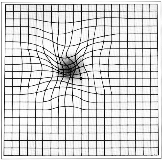 Macular Degeneration Test