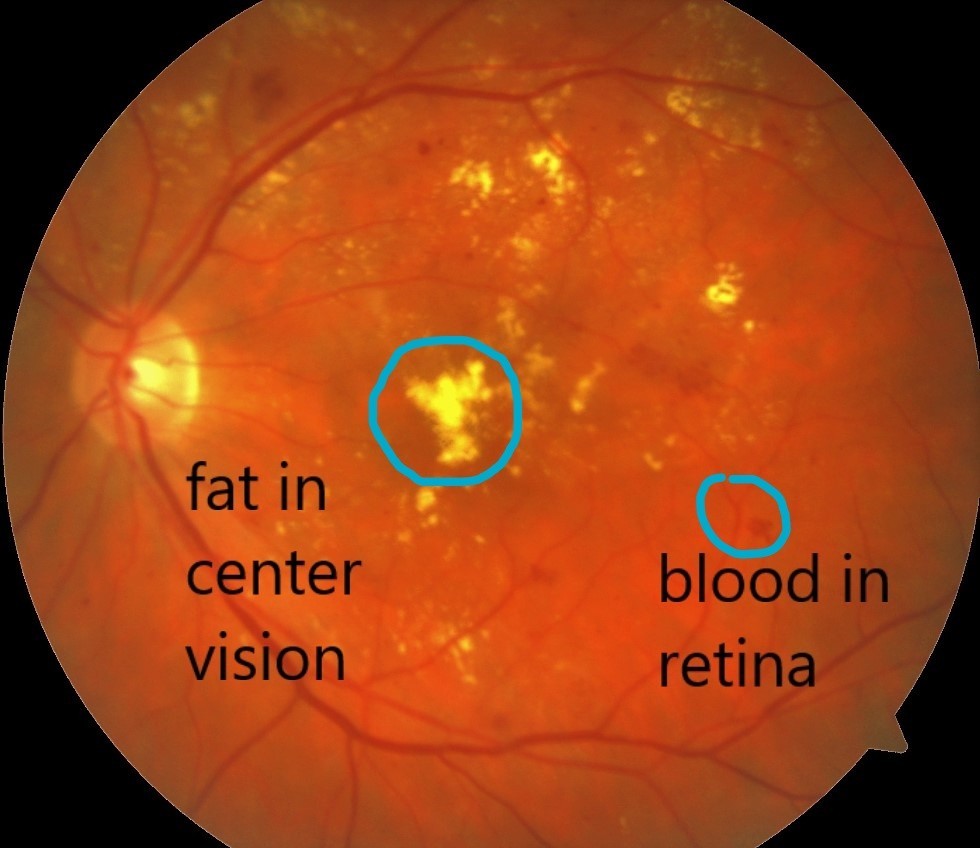 retina specialist